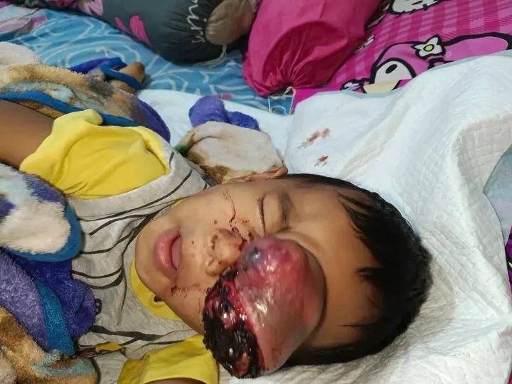 dokter. Foto. Saat tidur Kenzo mengerang kesakitan